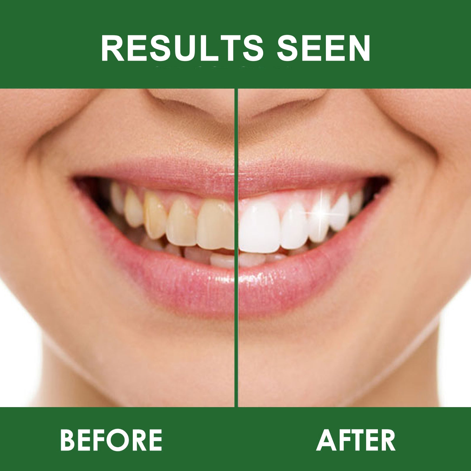 Teeth Whitening Strips - Gentle Teeth Oral Care | 14 Strips | Dropship