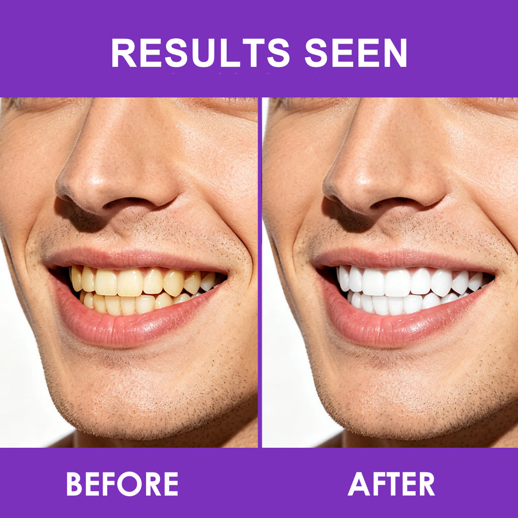 Teeth Whitening Strips - Oral Brightening Care | 7 Packs | Dropship